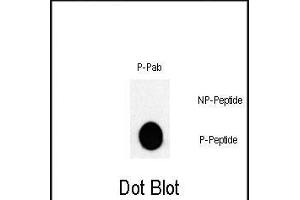 Dot blot analysis of Phospho-JUN- Pab (Cat. (C-JUN Antikörper  (pThr243))