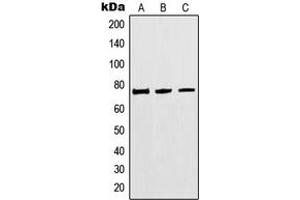 Western blot analysis of MTHFR expression in HEK293 (A), Jurkat (B), A549 (C) whole cell lysates. (MTHFR Antikörper  (Center))