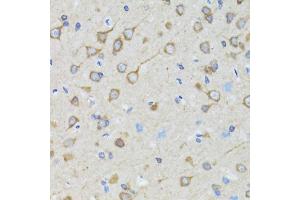 Immunohistochemistry of paraffin-embedded rat brain using TOLLIP antibody. (TOLLIP Antikörper)