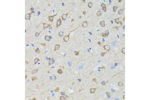 Immunohistochemistry of paraffin-embedded rat brain using TOLLIP antibody.