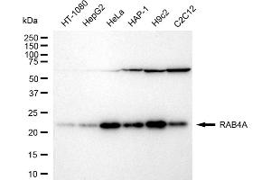 Western blotting analysis using RAB4A antibody (ABIN7800097).