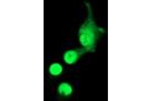 Anti-ACD mouse monoclonal antibody (ABIN2455492) immunofluorescent staining of COS7 cells transiently transfected by pCMV6-ENTRY ACD (RC204381). (ACD Antikörper)
