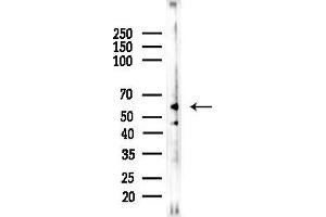 Western blot analysis of lysates from F10-LUC cells(UV,30 min treatment), using GRK7 Antibody at 1/1000 dilution.