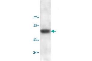 Western blot analysis of human skin lysate with ADAMTS2 polyclonal antibody  at 1 : 100 dilution. (Adamts2 Antikörper  (C-Term))
