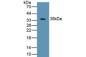 Detection of Recombinant DEFb2, Rat using Polyclonal Antibody to Defensin Beta 2 (DEFb2) (beta 2 Defensin Antikörper  (AA 23-63))