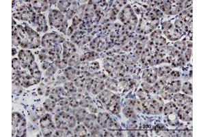 Image no. 1 for anti-LIM Domains Containing 1 (LIMD1) (AA 577-675) antibody (ABIN599481) (LIMD1 Antikörper  (AA 577-675))