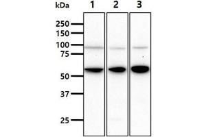 The cell lysates (40ug) were resolved by SDS-PAGE, transferred to PVDF membrane and probed with anti-human HSPA13 antibody (1:1000). (HSPA13 Antikörper)
