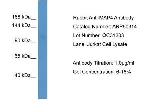 WB Suggested Anti-MAP4  Antibody Titration: 0. (MAP4 Antikörper  (N-Term))