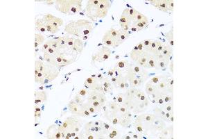 Immunohistochemistry of paraffin-embedded human stomach using RAB3IP antibody at dilution of 1:100 (x40 lens). (RAB3IP Antikörper)