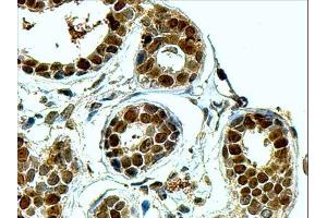 ABIN2561139 (4µg/ml) staining of paraffin embedded Human Breast. (APEX1 Antikörper  (N-Term))