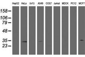 Western Blotting (WB) image for anti-Hydroxysteroid (17-Beta) Dehydrogenase 8 (HSD17B8) (AA 57-261) antibody (ABIN2715556)