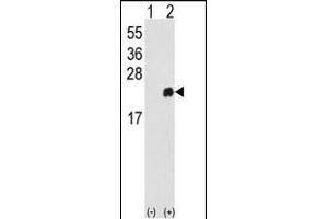 Western blot analysis of PRDX1 (arrow) using rabbit polyclonal PRDX1 Antibody (Center) (ABIN389467 and ABIN2839531). (Peroxiredoxin 1 Antikörper  (AA 88-116))