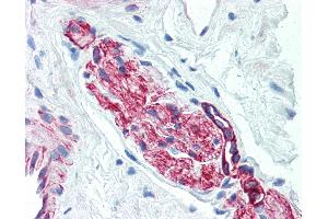 Anti-Nestin antibody IHC of human prostate, nerve. (Nestin Antikörper)