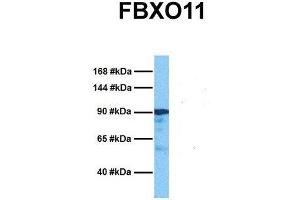 Host:  Rabbit  Target Name:  FBXO11  Sample Tissue:  Human Ovary Tumor  Antibody Dilution:  1. (FBXO11 Antikörper  (Middle Region))
