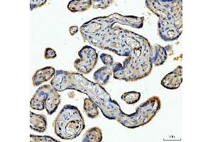 IHC analysis of ANGPTL4 using anti-ANGPTL4 antibody (ABIN5518734).