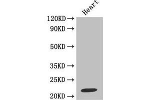 Western blotAll lanes: Metalloproteinase inhibitor 1 antibody at 2 μg/mlLane 1: Jurkat whole cell lysateLane 2: MCF-7 whole cell lysateSecondaryGoat polyclonal to rabbit at 1/10000 dilutionPredicted band size: 23 kDaObserved band size: 23 kDa. (TIMP1 Antikörper  (AA 24-207))