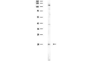 anti-ADP-Ribosylation Factor-Like 2 Binding Protein (ARL2BP) (Internal Region) antibody