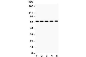 Western blot testing of HNF1A antibody and Lane 1:  rat liver;  2: (r) kidney;  3: (r) RH35;  4: human HeLa;  5: (h) HEPG2. (HNF1A Antikörper  (AA 431-631))