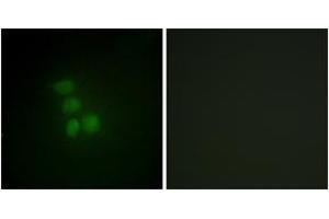 Immunofluorescence (IF) image for anti-RNA Binding Motif Protein, X-Linked (RBMX) (AA 6-55) antibody (ABIN2889468) (RBMX Antikörper  (AA 6-55))