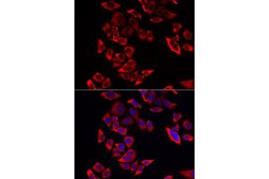 Immunofluorescence analysis of MCF-7 cells using RPL9 antibody. (RPL9 Antikörper  (AA 1-192))