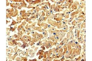 Immunohistochemistry of paraffin-embedded human heart tissue using ABIN7175734 at dilution of 1:100 (WDR27 Antikörper  (AA 501-730))