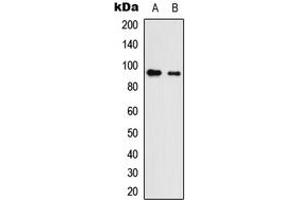 Western blot analysis of Neuroligin 3 expression in HEK293T (A), NS-1 (B) whole cell lysates. (Neuroligin 3 Antikörper  (C-Term))