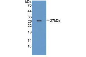 Western blot analysis of recombinant Human LRP1B. (LRP1B Antikörper  (AA 31-194))