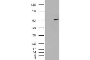 Western Blotting (WB) image for anti-Insulin-Like Growth Factor 2 mRNA Binding Protein 2 (IGF2BP2) (C-Term) antibody (ABIN2466526) (IGF2BP2 Antikörper  (C-Term))