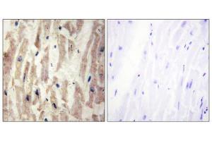 Immunohistochemistry analysis of paraffin-embedded human heart tissue using LAMA4 antibody. (LAMa4 Antikörper  (Internal Region))