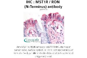 Image no. 1 for anti-Macrophage Stimulating 1 Receptor (C-Met-Related tyrosine Kinase) (MST1R) (N-Term) antibody (ABIN1737098) (MST1R Antikörper  (N-Term))