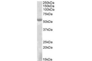Image no. 1 for anti-Eyes Absent Homolog 1 (EYA1) (Internal Region) antibody (ABIN487975) (EYA1 Antikörper  (Internal Region))