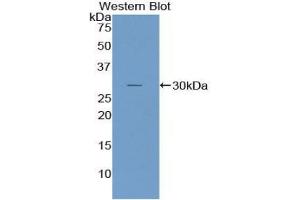 Western blot analysis of the recombinant protein. (NUP107 Antikörper  (AA 554-784))