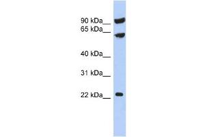 TIGD3 antibody used at 1 ug/ml to detect target protein. (TIGD3 Antikörper  (Middle Region))