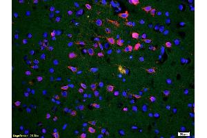Immunofluorescence (IF) image for anti-Receptor Tyrosine Kinase-Like Orphan Receptor 1 (ROR1) (AA 301-360) antibody (ABIN1387717)