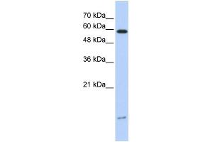 Western Blotting (WB) image for anti-Dynein, Light Chain, LC8-Type 1 (DYNLL1) (N-Term) antibody (ABIN2784529)