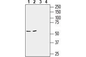 Western blot analysis of mouse brain (lanes 1 and 3) and colon (lanes 2 and 4) lysates: - 1,2. (Slc6a14 Antikörper  (2nd Extracellular Loop))