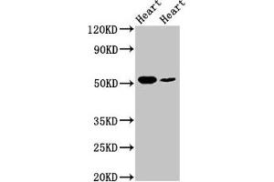 Western Blot Positive WB detected in: Rat heart tissue, Mouse heart tissue All lanes: ILK antibody at 5 μg/mL Secondary Goat polyclonal to rabbit IgG at 1/50000 dilution Predicted band size: 52, 45, 37 kDa Observed band size: 52 kDa (ILK Antikörper  (AA 1-228))