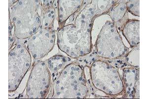 Immunohistochemical staining of paraffin-embedded Human Kidney tissue using anti-LDLRAP1 mouse monoclonal antibody. (LDLRAP1 Antikörper)