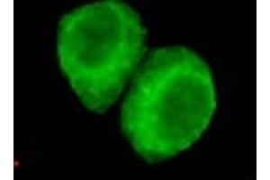 Immunocytochemistry of HeLa cells using anti-JMJD6(N-terminus) mouse mAb diluted 1:200. (JMJD6 Antikörper  (N-Term))