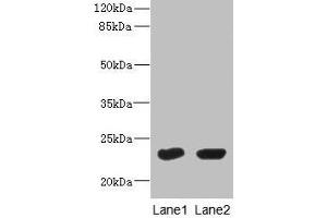 Western Blot All lanes: UBE2T antibody at 10 μg/mL Lane 1: HepG2 whole cell lysate Lane 2: Hela whole cell lysate Secondary Goat polyclonal to rabbit IgG at 1/10000 dilution Predicted band size: 23 kDa Observed band size: 23 kDa