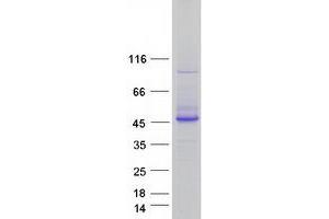 Western Blotting (WB) image for 3'(2'), 5'-Bisphosphate Nucleotidase 1 (BPNT1) protein (Myc-DYKDDDDK Tag) (ABIN2715323)