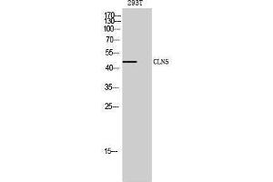 Western Blotting (WB) image for anti-Ceroid-Lipofuscinosis, Neuronal 5 (CLN5) (Internal Region) antibody (ABIN3174448) (CLN5 Antikörper  (Internal Region))
