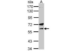 WB Image Sample(30 μg of whole cell lysate) A:H1299 7. (LCK Antikörper  (C-Term))