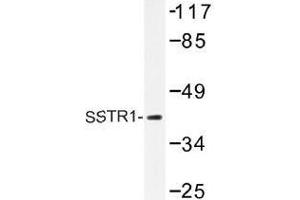 Image no. 1 for anti-Somatostatin Receptor 1 (SSTR1) antibody (ABIN317866) (SSTR1 Antikörper)