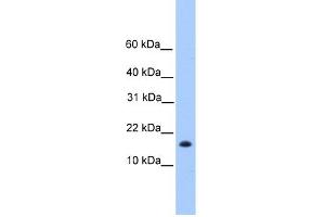 WB Suggested Anti-C6orf173 Antibody Titration: 0. (CENPW Antikörper  (N-Term))