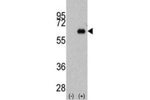 Western blot analysis of anti-Myc antibody and 293 cell lysate (2 ug/lane) either nontransfected (Lane 1) or transiently transfected with the MYC gene (2). (c-MYC Antikörper  (AA 40-69))
