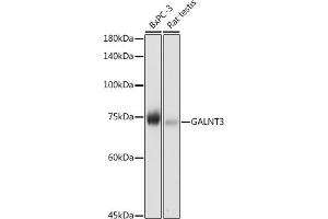 Western blot analysis of extracts of various cell lines, using G antibody (ABIN6131444, ABIN6140942, ABIN6140944 and ABIN6218180) at 1:1000 dilution. (GALNT3 Antikörper  (AA 1-140))