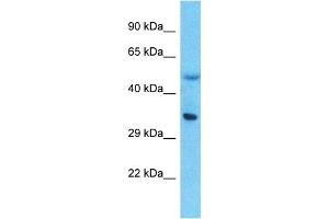 Western Blotting (WB) image for anti-Lipid Phosphate Phosphatase-Related Protein Type 5 (LPPR5) (N-Term) antibody (ABIN5517408)