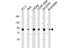 All lanes : Anti-TGM4 Antibody (Center) at 1:1000-1:2000 dilution Lane 1: PC-3 whole cell lysateLane 2: Hela whole cell lysate Lane 3: LNCap whole cell lysate Lane 4: CCRF-CEM whole cell lysate Lane 5: SH-SY5Y whole cell lysate Lane 6: Mouse prostate whole tissue lysate Lysates/proteins at 20 μg per lane. (TGM4 Antikörper  (AA 135-164))