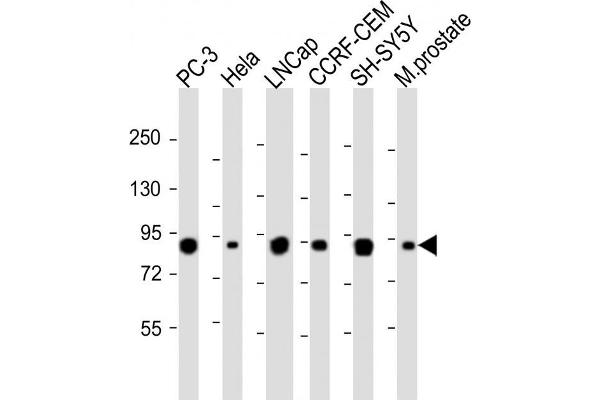 TGM4 Antikörper  (AA 135-164)